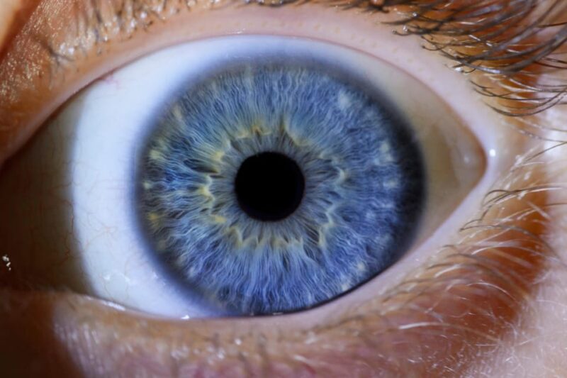 IRIS Photography (Macro Photo of Your Eye) - Suitable Participants